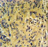 TESC Antibody (aa88-116)