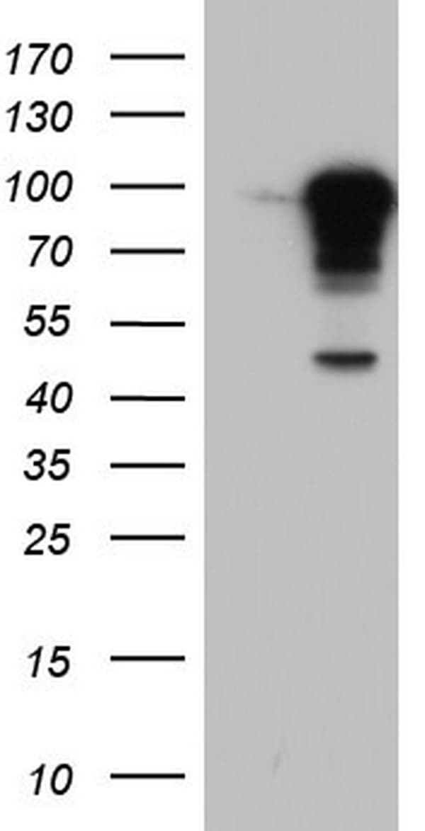 BFSP1 / Filensin Antibody (aa405-665, clone OTI3C11, Carrier-free)