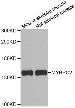 Polyclonal Rabbit anti-Human MYBPC2 Antibody (IHC, WB)