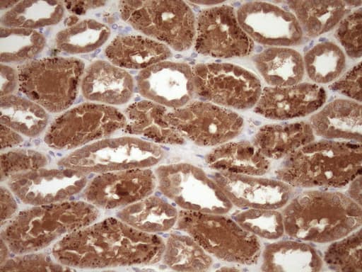 Monoclonal Mouse anti-Human FSCN1 / Fascin Antibody (clone OTI3B4, IHC, WB)