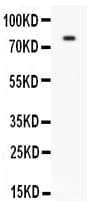 PECAM-1 / CD31 Antibody (aa717-732)
