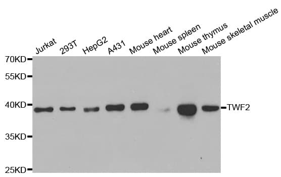 Polyclonal Rabbit anti-Human TWF2 / PTK9L Antibody (IHC, WB)