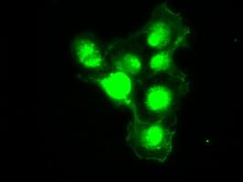 PMEL / SILV / gp100 Antibody (clone OTI8A4)
