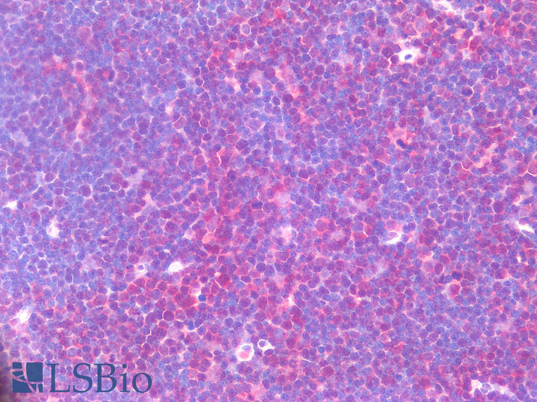 IHC-plus™ Polyclonal Rabbit anti-Human AML1 / RUNX1 Antibody (IHC)