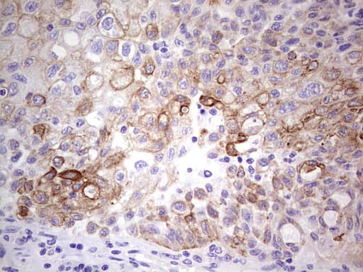 Peripherin Antibody (clone OTI3F4)