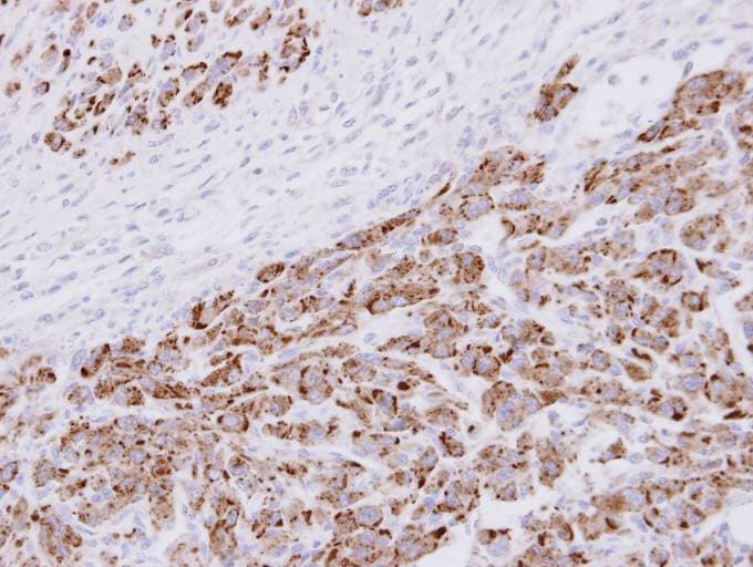 PSMA3 Antibody (aa1-137)