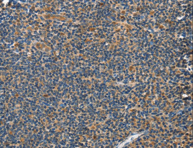 Polyclonal Rabbit anti-Human GRB7 Antibody (IHC)