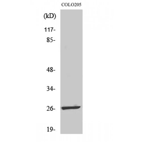 Polyclonal Rabbit anti-Human LDOC1L Antibody (110-190 aa, Internal, IHC, WB)