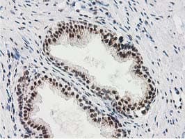 MGLL / Monoacylglycerol Lipase Antibody (clone OTI2B11)
