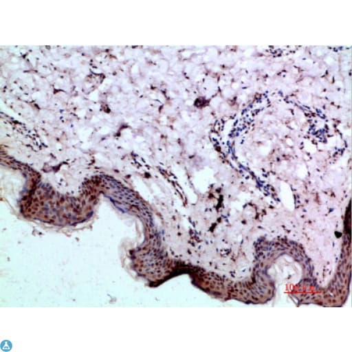 BMP1 Antibody