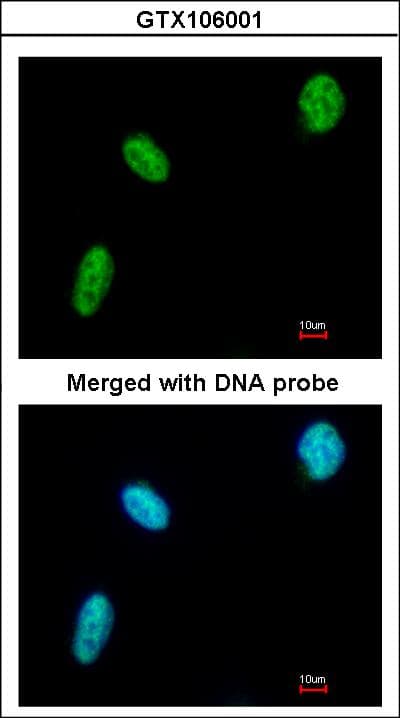 IHC-plus™ DDX39 Antibody (aa53-425)