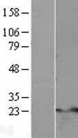 TNFAIP8 / SCC-S2 Protein (Over-Expression Lysate Myc-DDK (Flag))