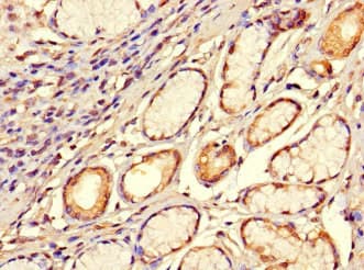 Polyclonal Rabbit anti-Human SMOC1 Antibody (IHC, IF, WB)
