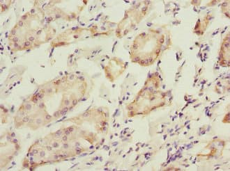 PDIA6 / ERP5 Antibody