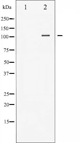 FAK / Focal Adhesion Kinase Antibody