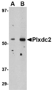 Polyclonal Rabbit anti-Human PLXDC2 Antibody (IHC, IF, WB)