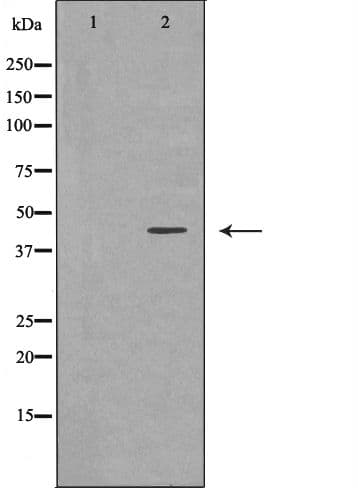 LETMD1 / HCCR1 Antibody
