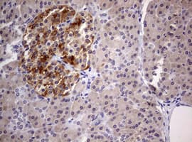 Monoclonal Mouse anti-Human DICER1 / Dicer Antibody (clone OTI1D9, aa1666-1922, IHC)