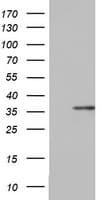 OTC Antibody (aa33-354, clone OTI2C12)