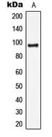 Polyclonal Rabbit anti-Human LIG4 / DNA Ligase IV Antibody (Internal, IHC, IF, WB)