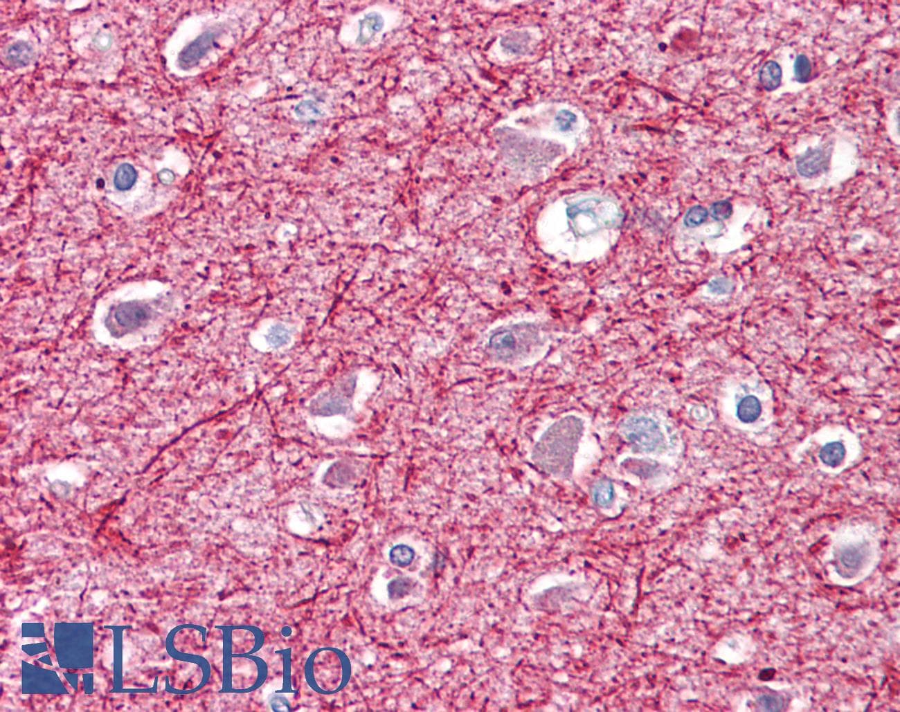 PathPlus™ NEFM / NF-M Antibody (clone RNF406)