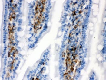 CALD1 / Caldesmon Antibody