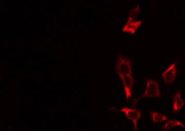 Polyclonal Rabbit anti-Human ABCC10 Antibody (IF, WB)