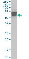 ETV6 / TEL Antibody (clone 3B10)