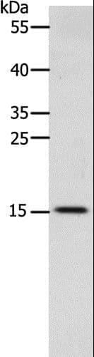 Polyclonal Rabbit anti-Human CST3 / Cystatin C Antibody (IHC, WB)