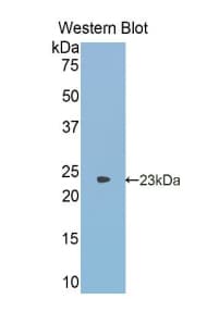 ANGPTL2 / ARP2 Antibody (aa47-207, HRP)