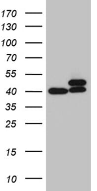 Monoclonal Mouse anti-Human RPSA / Laminin Receptor Antibody (clone OTI1G3, aa2-295, IHC, WB)