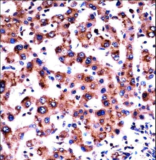 Polyclonal Rabbit anti-Human HRH1 / Histamine H1 Receptor Antibody (aa273-301, IHC, WB)