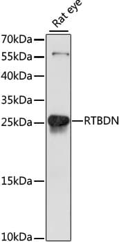 RTBDN / Retbindin Antibody