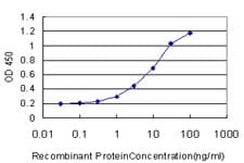 Monoclonal Mouse anti-Human SCN3A / Nav1.3 Antibody (clone 3F3, WB)
