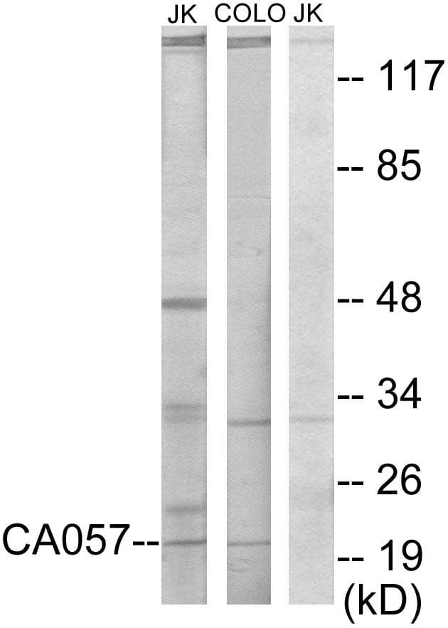 NTPCR / C1orf57 Antibody
