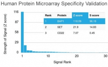 BAP1 Antibody (clone BAP1/2432)