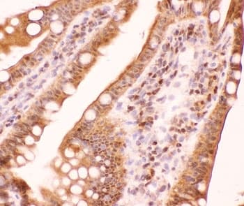 Polyclonal Rabbit anti-Human AML1 / RUNX1 Antibody (aa227-257, IHC, WB)