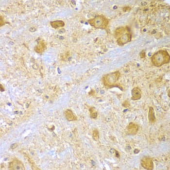 Polyclonal Rabbit anti-Human SPAG16 Antibody (IHC, WB)