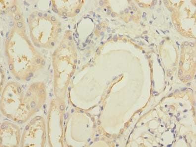 Polyclonal Rabbit anti-Human MCM9 Antibody (IHC, WB)