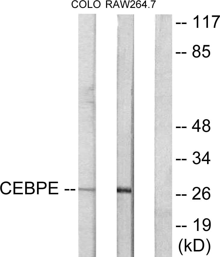 CEBPD + CEBPE Antibody (C-Terminus)