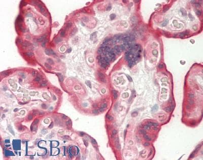 Polyclonal Rabbit anti-Human Dysferlin Antibody (aa1296-1345, IHC, WB)