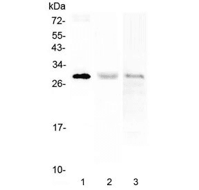 Polyclonal Rabbit anti-Human PTCRA Antibody (WB)