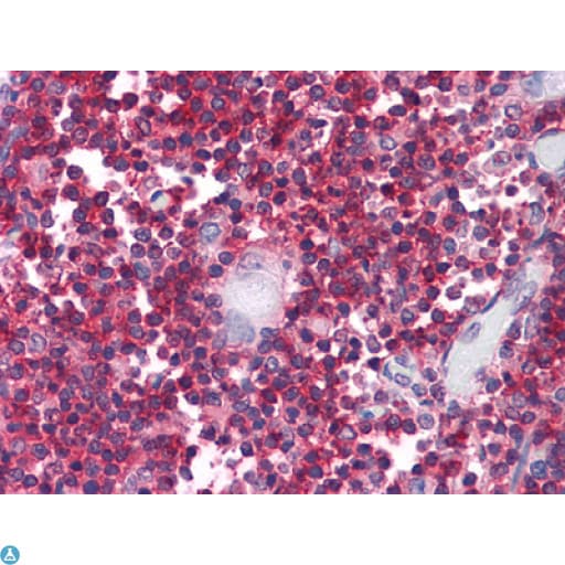 CD247 / CD3 Zeta Antibody