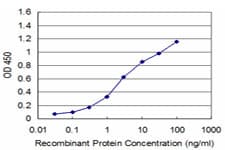 IHC-plus™ PDK2 Antibody (clone 2G1)