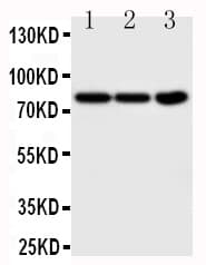NTRK1 / TrkA Antibody (aa71-90)