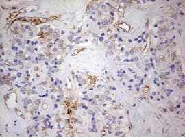 Monoclonal Mouse anti-Human KRT7 / CK7 / Cytokeratin 7 Antibody (clone OTI1B3, IHC, WB)