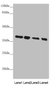 PPP1R8 / Rnase E Antibody