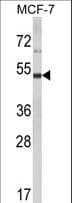 Polyclonal Rabbit anti-Human LUC7L2 Antibody (aa341-369, IHC, WB)