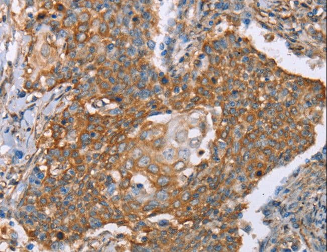 Polyclonal Rabbit anti-Human PAICS / ADE2 Antibody (IHC, WB)