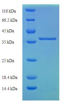 Human LYZL1 Protein (Recombinant His-SUMO)